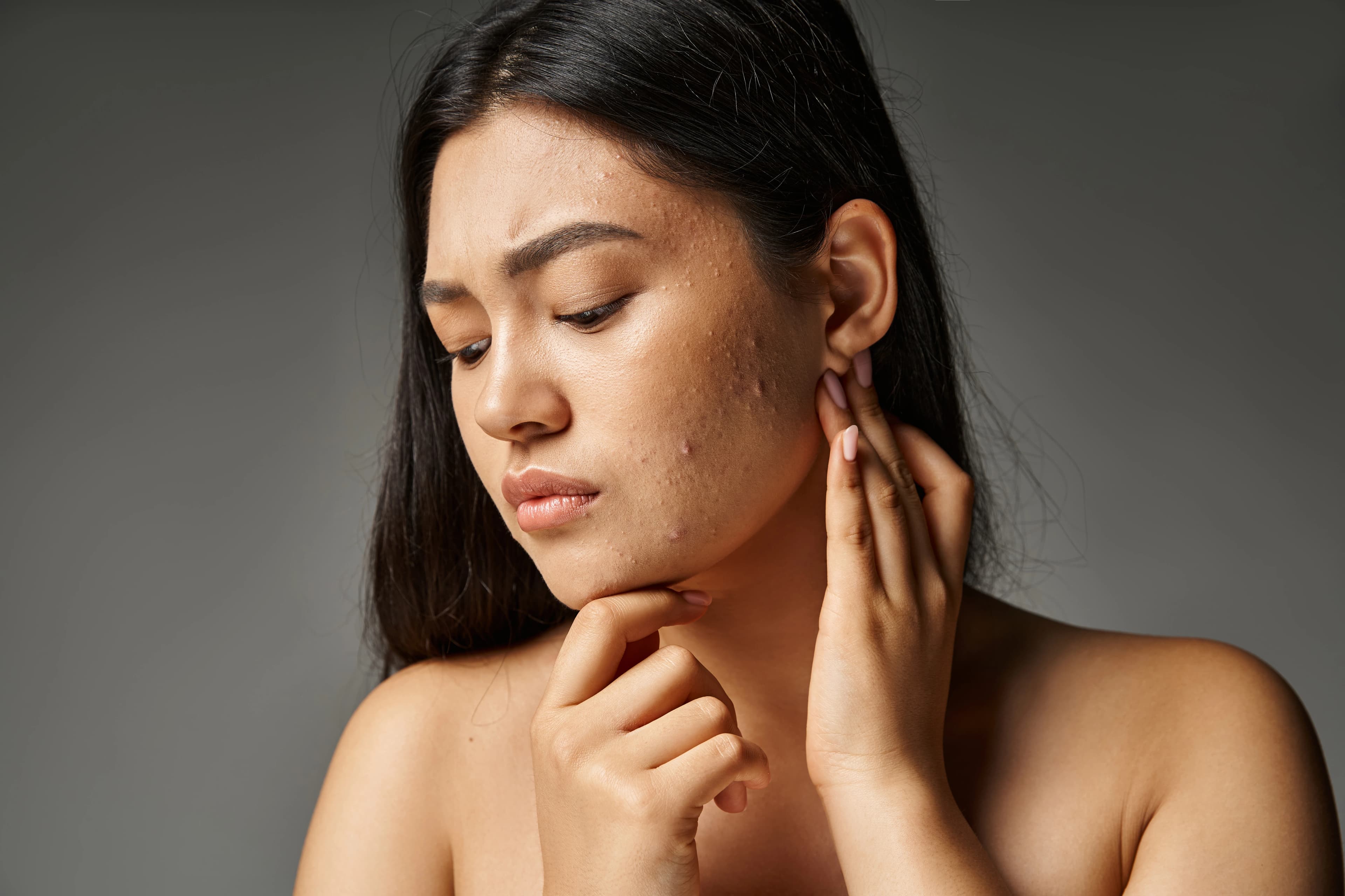 Dull Skin treatment