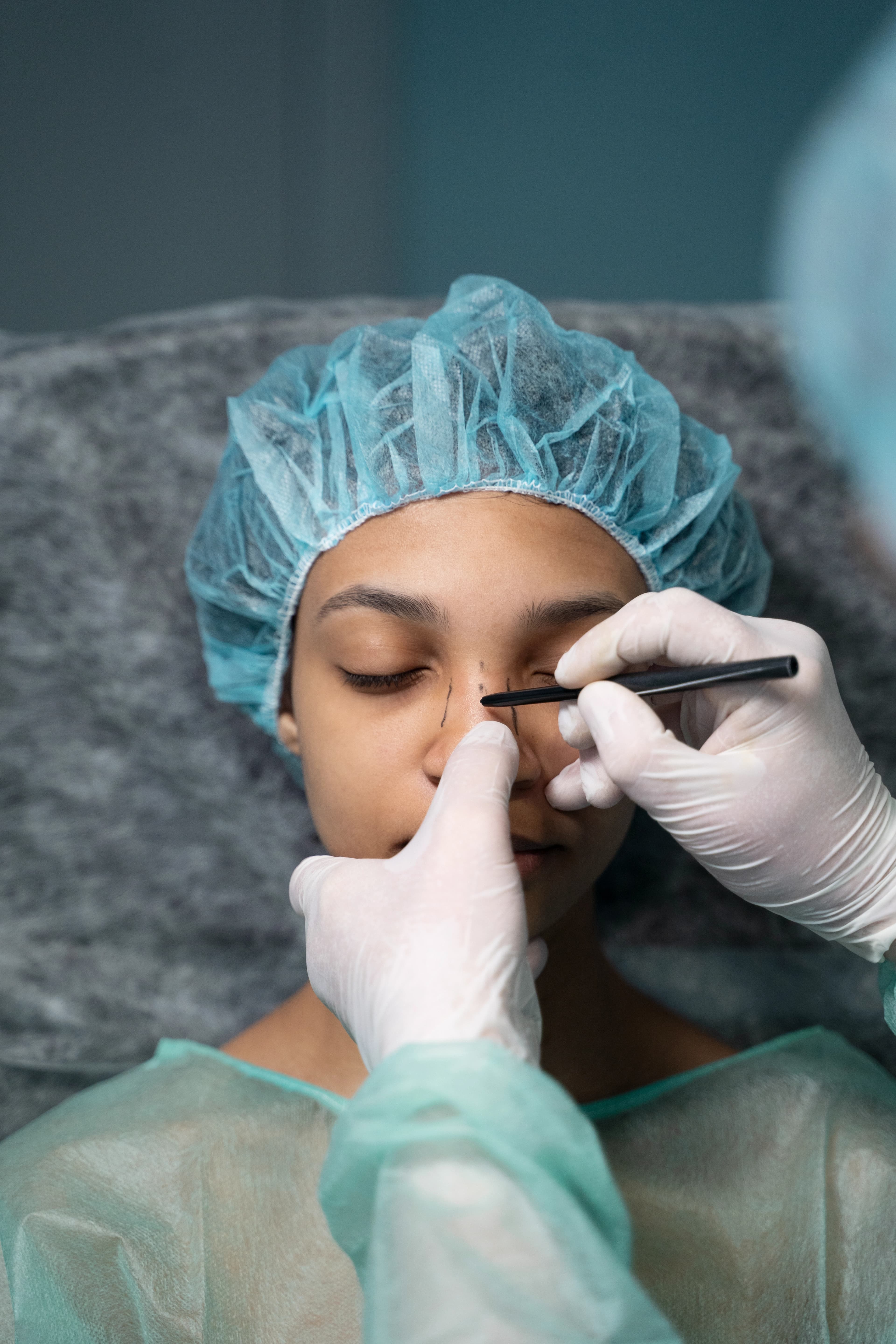 Thread Lift treatment